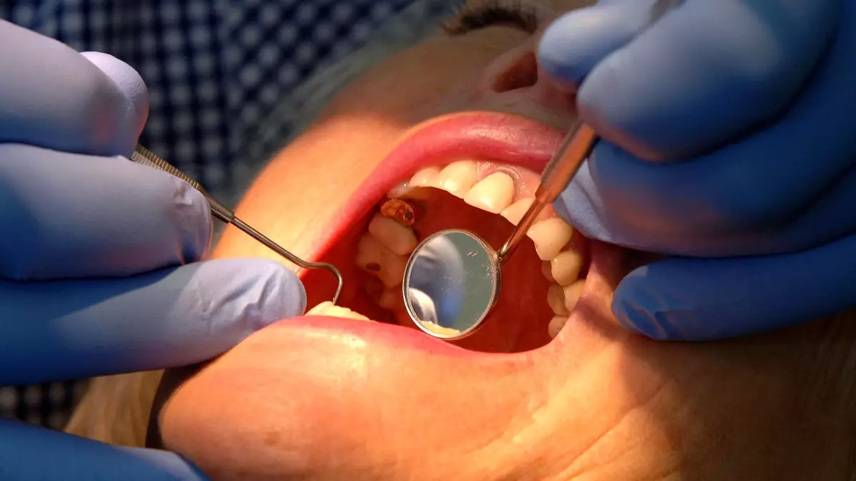 nottingham universitesinden dis minesini onaran yeni jel 3DYuKuym.jpg